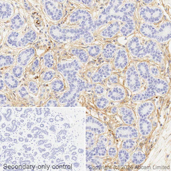 HRP Anti-Fibronectin antibody [EPR23110-25]