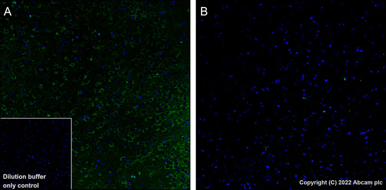 Alexa Fluor® 488 Anti-Tau (phospho T231) antibody [EPR2488]
