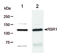 Anti-RBR1 | Retinoblastoma related protein