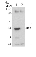 Anti-HPR | Hydroxypyruvate reductase (peroxisomal matrix marker)