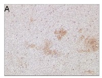 Anti-Amyloid beta oligomer-specific monoclonal antibody (OMAB)