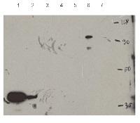 Anti-HDT1 | Histone deacetylase