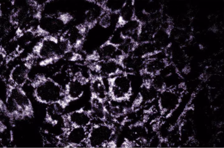 OPA1 Pure 18/OPA-1 50ug
