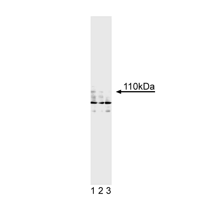 Purified Mouse Anti-Human Androgen Receptor(G122-434)