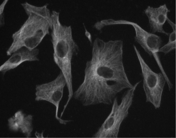 Purified Mouse Anti-β-Tubulin(5H1)