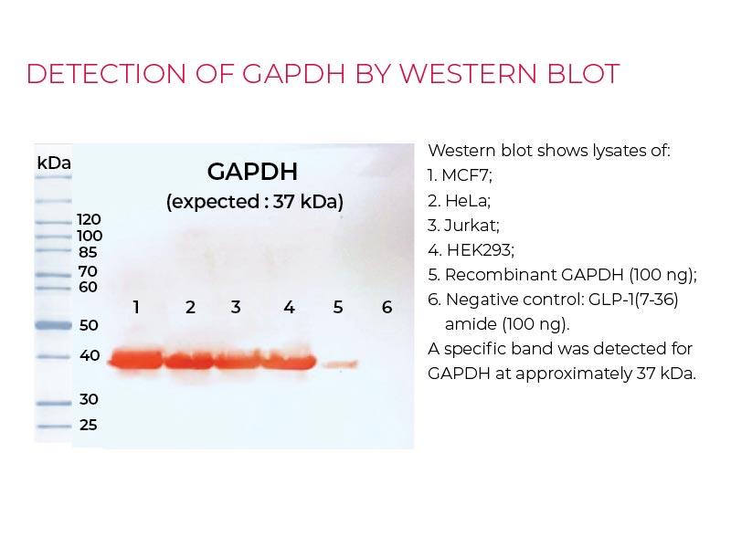Detection GAPDH by Western-blot Detection GAPDH by Western-blot