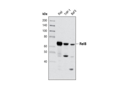 NF-kappaB Family Member Antibody Sampler Kit
