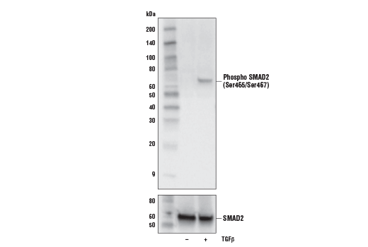 TGF-beta Fibrosis Pathway Antibody Sampler Kit