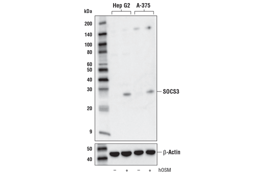 Jak/Stat Pathway Inhibitors Antibody Sampler Kit