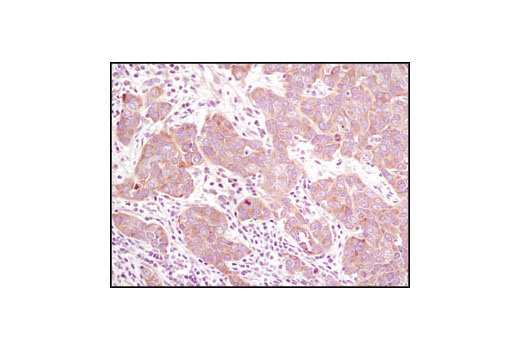 mTOR Regulation Antibody Sampler Kit