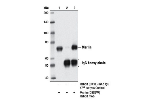 Hippo Pathway: Upstream Signaling Antibody Sampler Kit