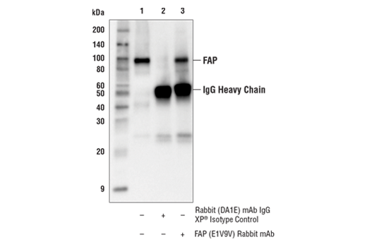 Cancer Associated Fibroblast Marker Antibody Sampler Kit