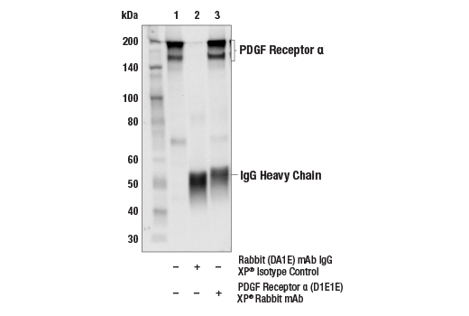 Cancer Associated Fibroblast Marker Antibody Sampler Kit