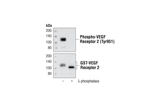 Phospho-VEGF Receptor 2 Antibody Sampler Kit