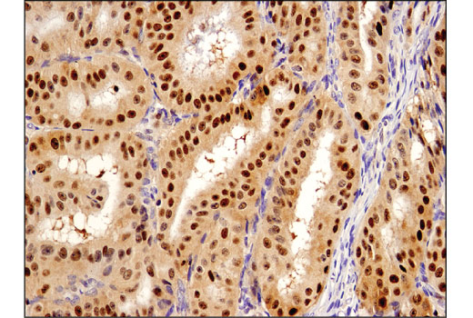 Human Reactive Cell Death and Autophagy Antibody Sampler Kit