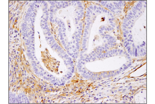 NF-kappaB Family Antibody Sampler Kit II