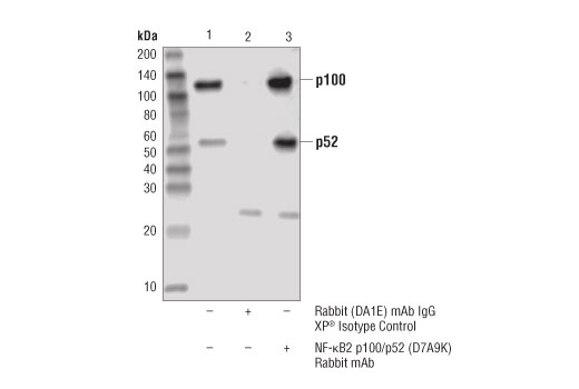 NF-kappaB Family Antibody Sampler Kit II