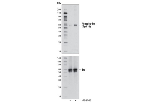 Angiogenesis Antibody Sampler Kit