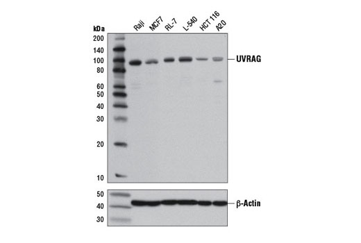 Beclin-1 Complex Antibody Sampler Kit