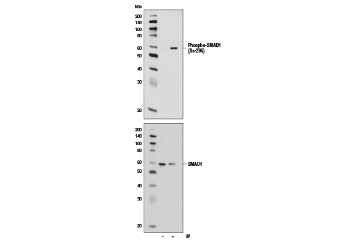 SMAD 1/5/9 Antibody Sampler Kit
