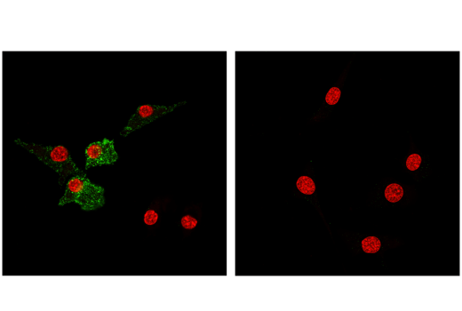 Mouse Immune Cell Phenotyping IHC Antibody Sampler Kit