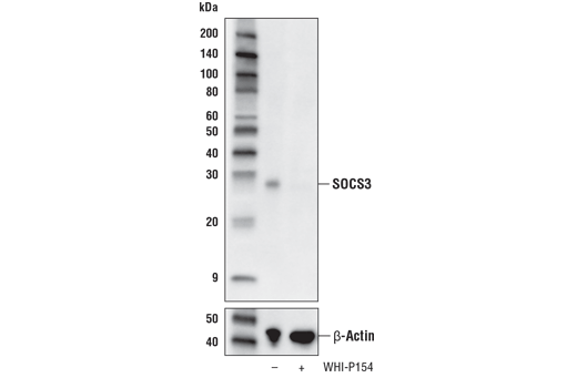 Jak/Stat Pathway Inhibitors Antibody Sampler Kit