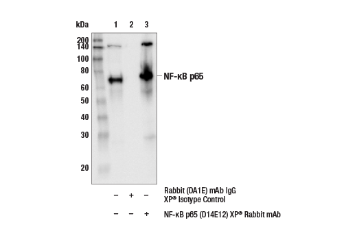 NF-kappaB Pathway Antibody Sampler Kit