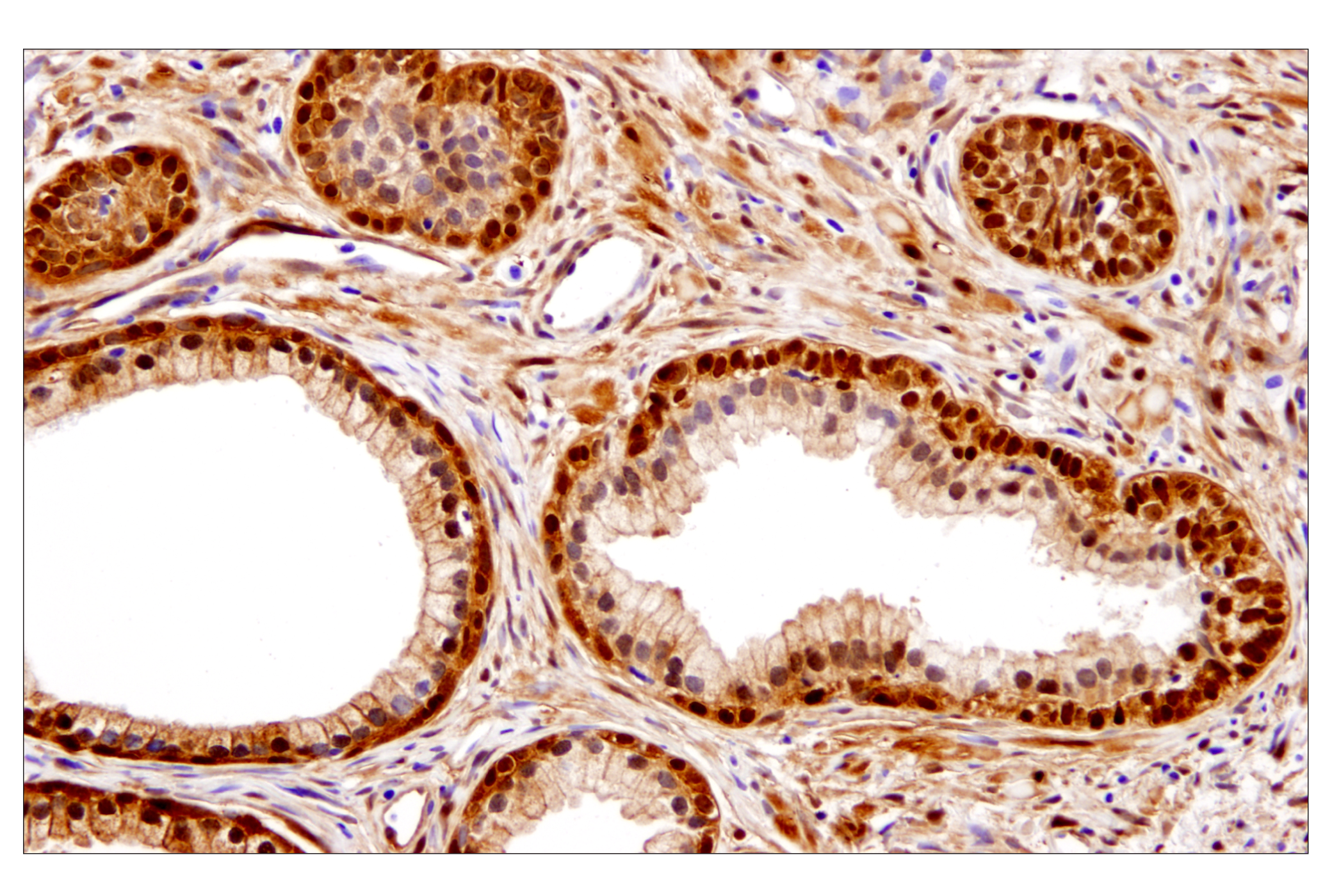 Hippo Pathway: Upstream Signaling Antibody Sampler Kit