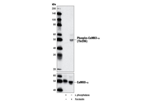 Phospho-CaMKII (Thr286) (D21E4) Rabbit mAb