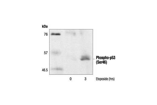 p53 Antibody Sampler Kit