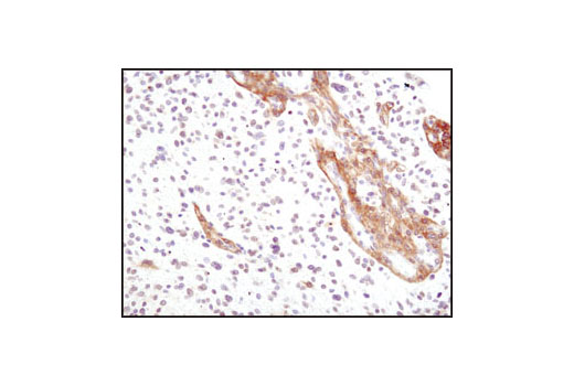 Cancer Associated Fibroblast Marker Antibody Sampler Kit