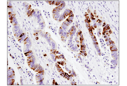 MUC5AC (E3O9I) XP ®  Rabbit mAb