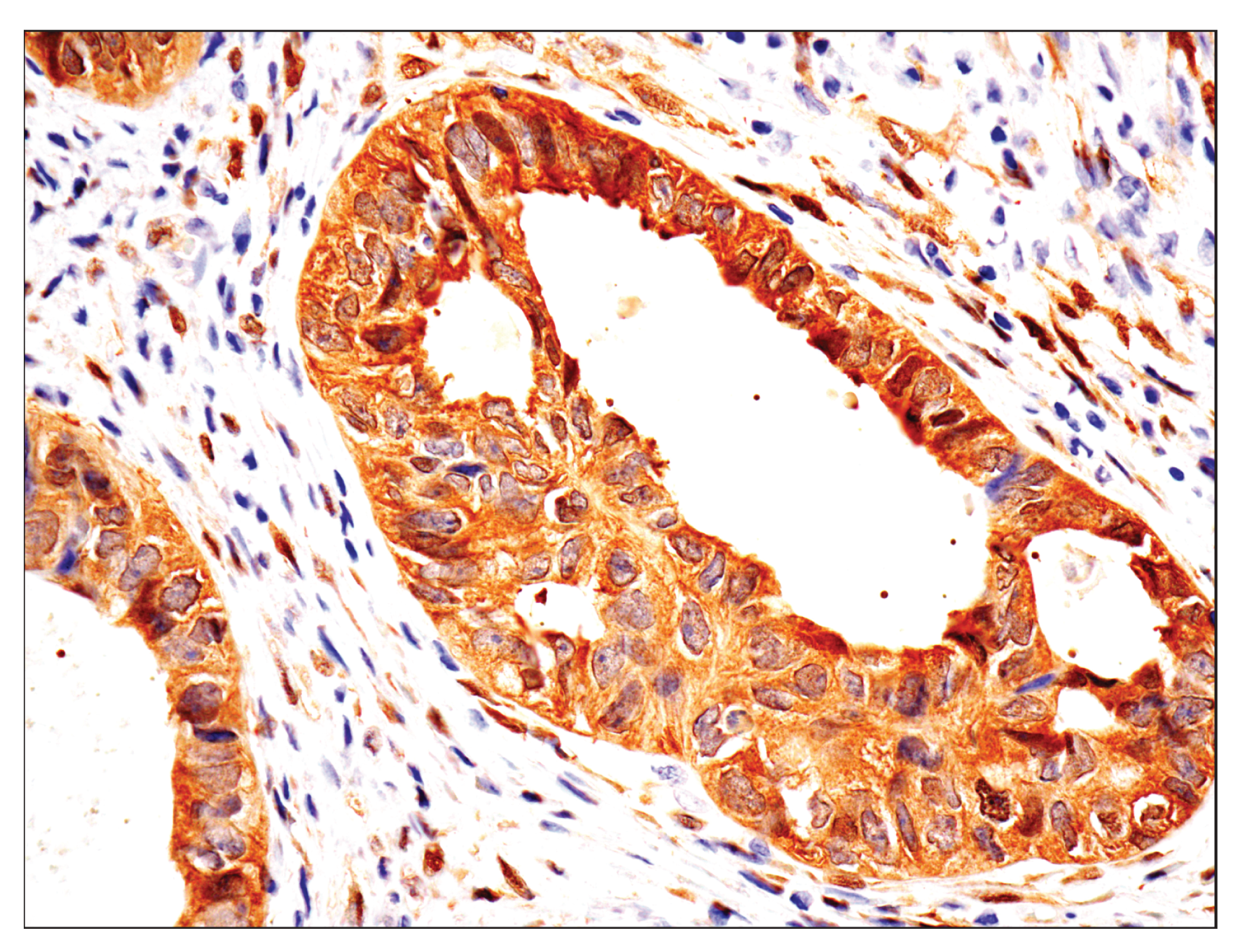 Hippo Pathway: Upstream Signaling Antibody Sampler Kit