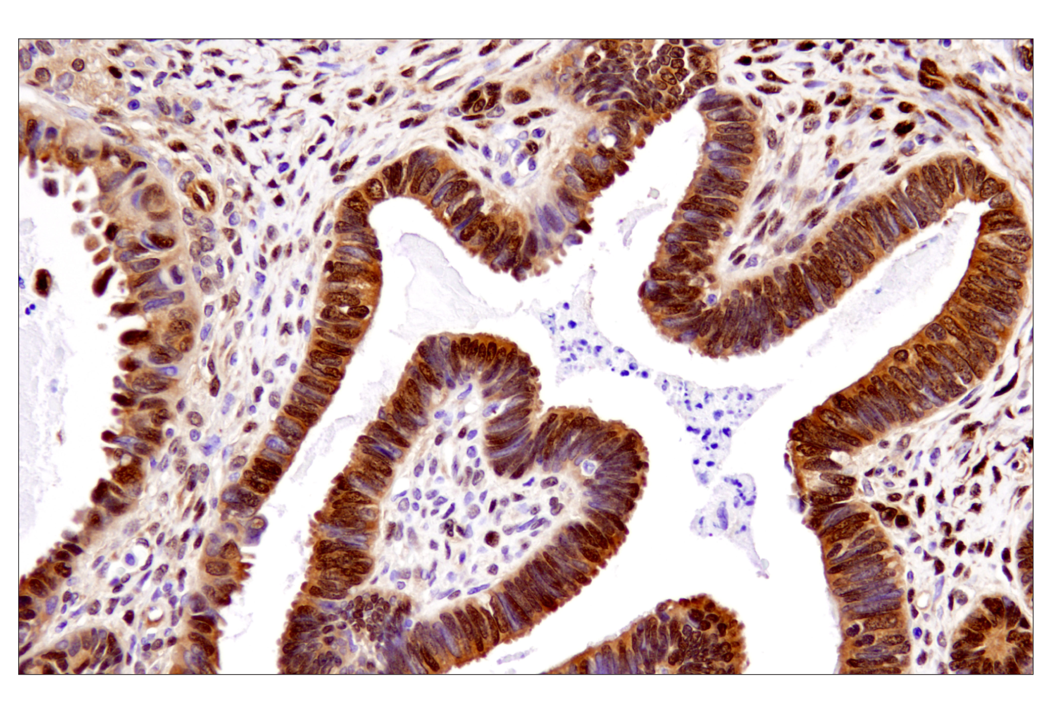 Hippo Pathway: Upstream Signaling Antibody Sampler Kit