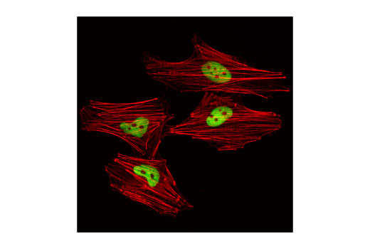 Class I HDAC Antibody Sampler Kit