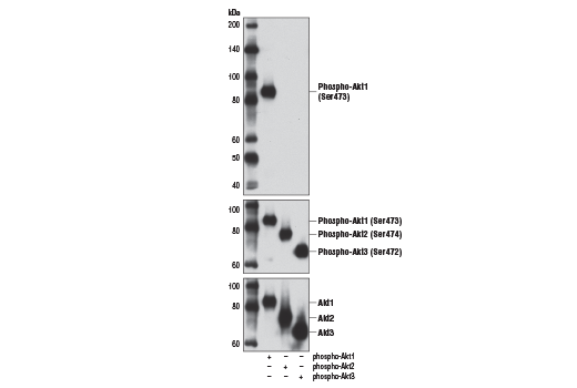 Phospho-Akt Isoform Antibody Sampler Kit