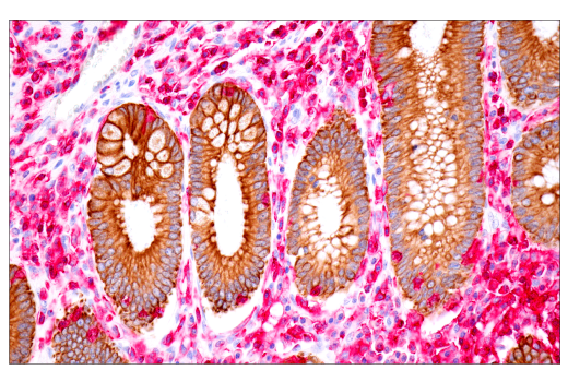 SignalStain ®  IHC Dual Staining Kit (AP, Rabbit, Red / HRP, Mouse, Brown)