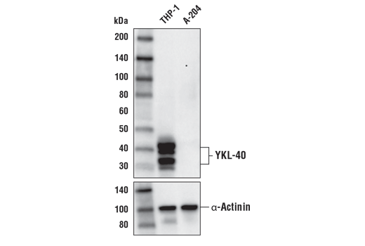 TGF-beta Fibrosis Pathway Antibody Sampler Kit