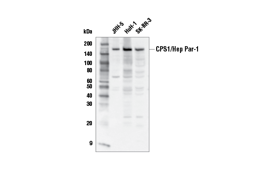 CPS1/Hep Par-1 Antibody