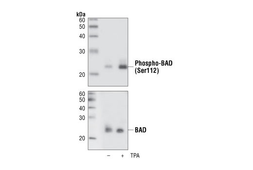 Phospho-Bad (Ser112) (40A9) Rabbit mAb (BSA and Azide Free)