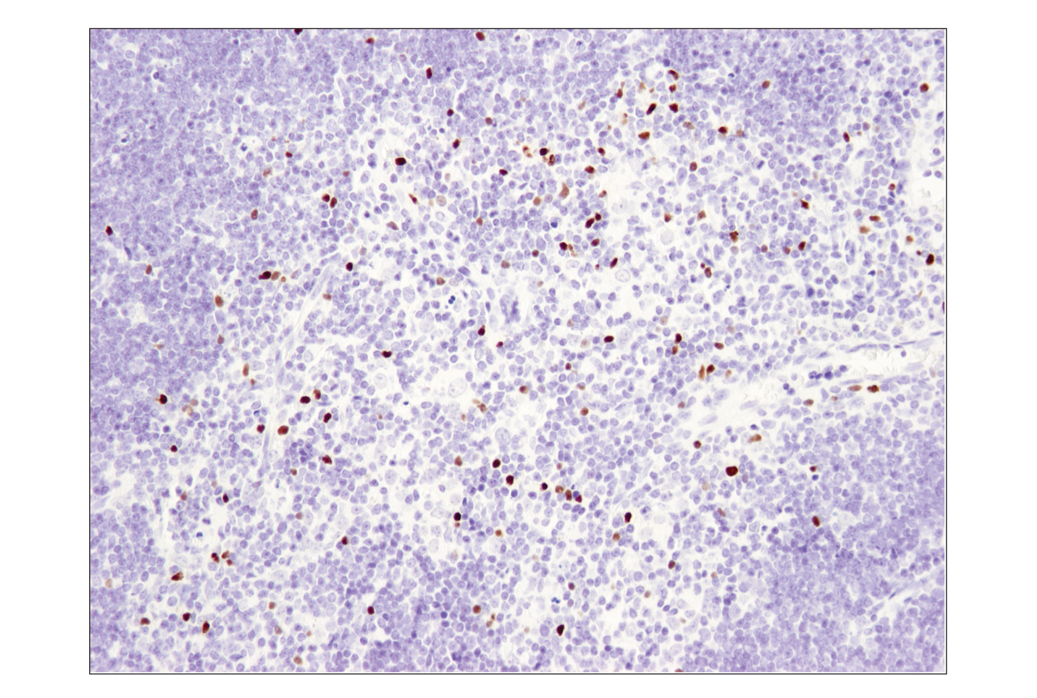Mouse Immune Cell Phenotyping IHC Antibody Sampler Kit