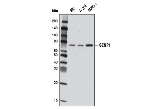 SENP1 (D16D7) Rabbit mAb