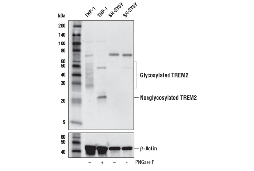 Human TREM2 Activity Antibody Sampler Kit