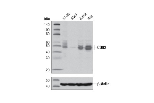 CD82 (D7G6H) Rabbit mAb