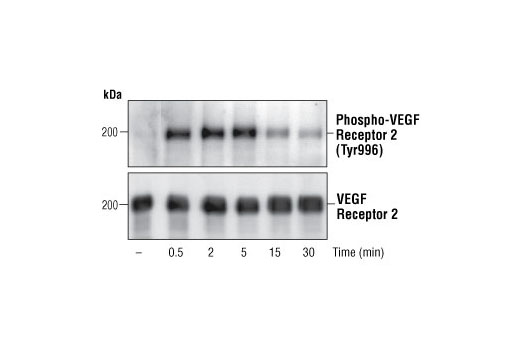 Phospho-VEGF Receptor 2 Antibody Sampler Kit