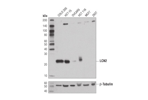 LCN2 (D4M8L) Rabbit mAb