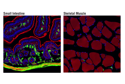 Cancer Associated Fibroblast Marker Antibody Sampler Kit