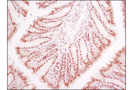 Hypoxia Pathway Antibody Sampler Kit