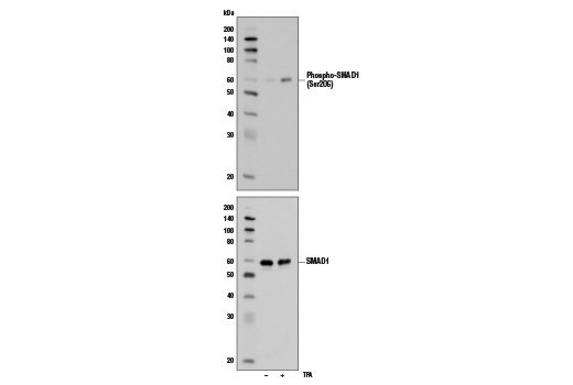 SMAD 1/5/9 Antibody Sampler Kit