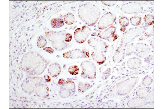 Notch Activated Targets Antibody Sampler Kit